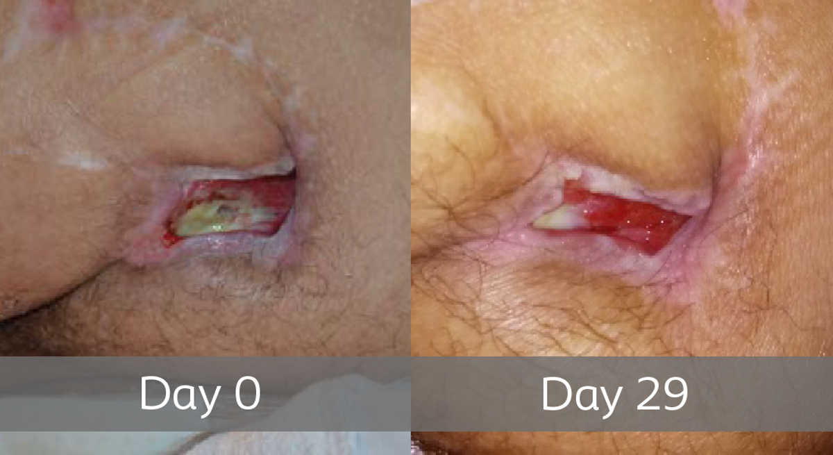 Patientcases