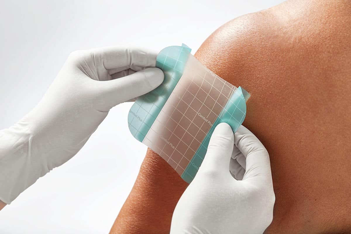 Hvordan vælger jeg den rigtige hydrokolloidbandage?